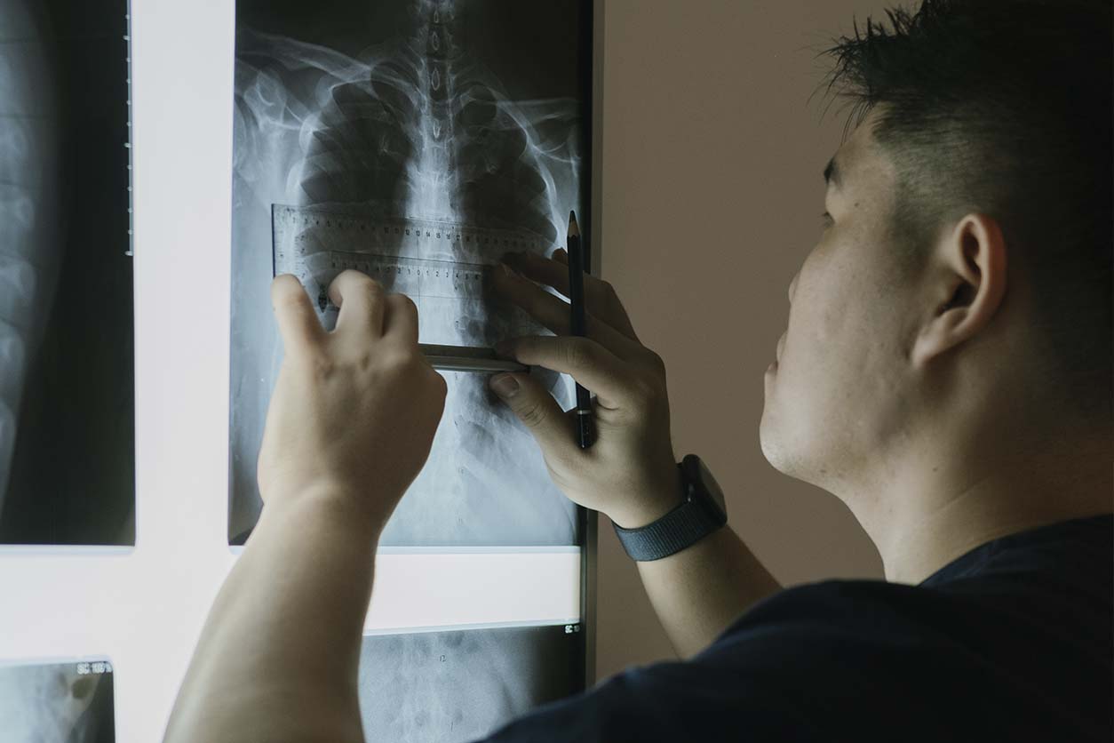 X-Ray Analysis