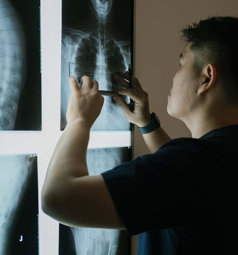 X-ray Analysis